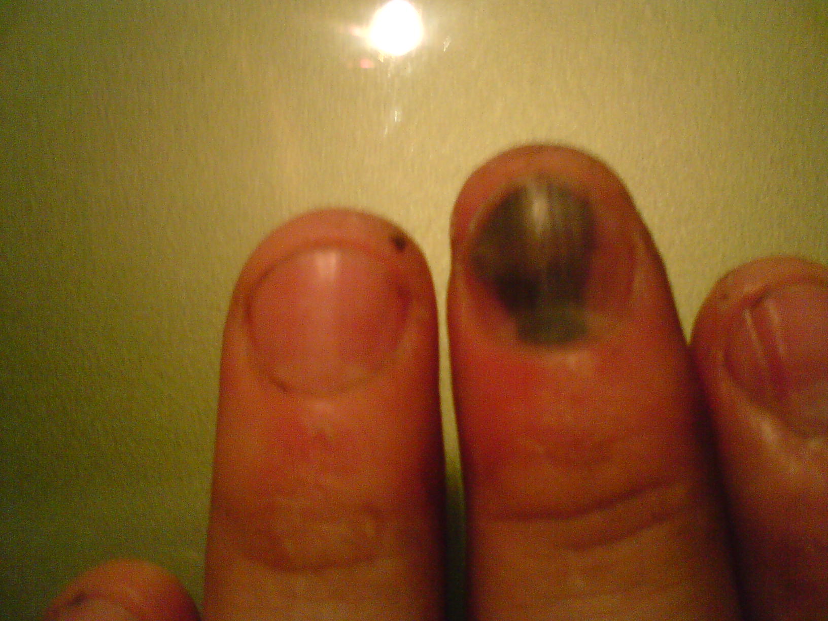 det var så vondt.. at du kan ikke innbille deg det engang..